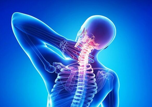 tepalas su skausmo kaklo su osteochondroze skausmas raumenyse ir sąnariuose apatinėje nugaros gydymas