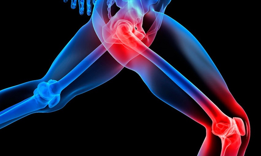 skausmas tabletes skausmo jungtiniame pavadinimų iš osteochondrozė i