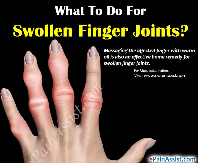 swollen painful knuckle joints su amžiumi susijusių kremzlės audinio gydymas