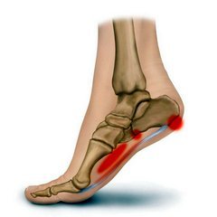 ką daryti kai pėdos sąnarių skauda reumatoidinis artritas iš peties sąnario gydymo
