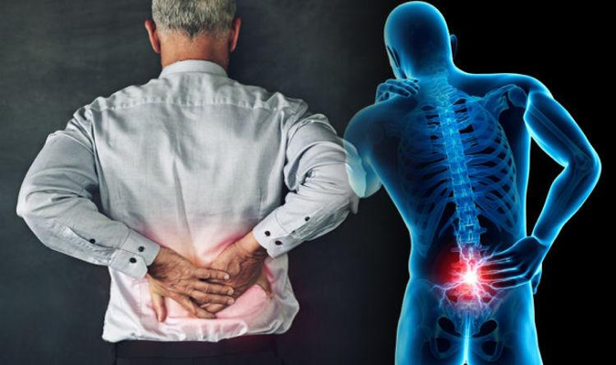 nugaros skausmas stuburo apacioje kaip artrito gydymui japonija