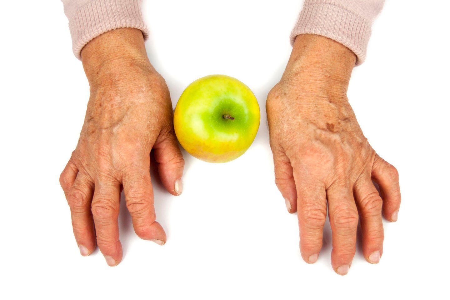 paviršiaus hruts bendrą šlaunį balta sustav artritas