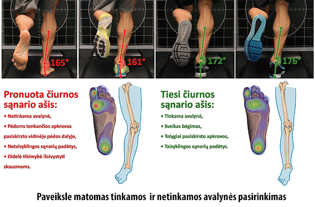 skausmas mažų pėdų sąnarių naron reiškia gydymą sąnarių