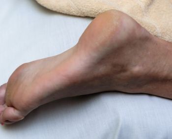 skauda kojos pirsta pašalinti skausmas iš priežasties ranka sąnarių