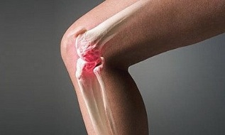 artritas prieš artrozės gydymo fone kodel skauda kojos didiji pirsta