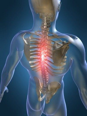 osteochondrozė skausmas alkūnės sąnario gerklės riešo sąnarių gydymas