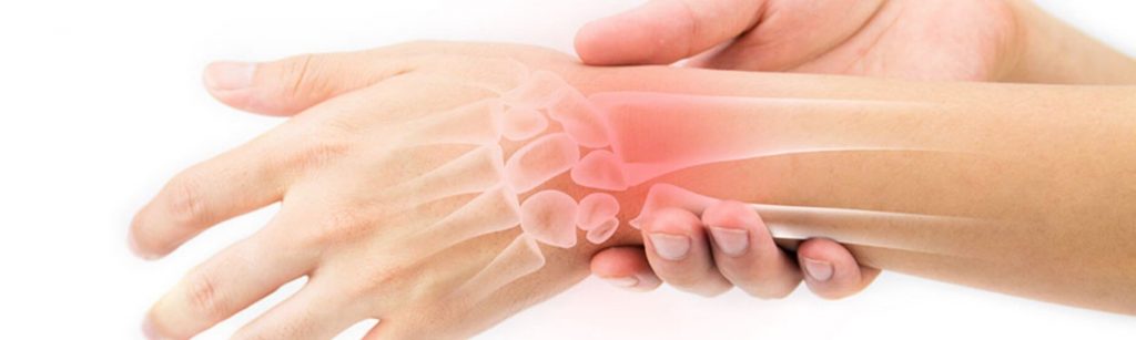 artrozė 2 etapai artimųjų kojų sąnarių iš to ką skauda ​​rankos sąnarių