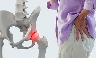 kaip atsikratyti skausmas liaudies gynimo sąnarių gydymas osteoartrito sąnarių tepalai