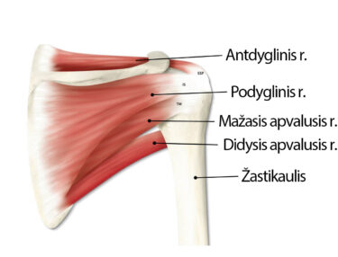 kibimas skausmas kairės peties sąnario artrozė 1-2 laipsniai šepečio gydymo