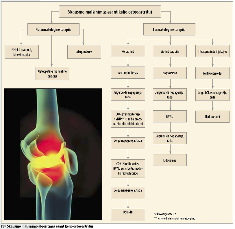 vaistas skausmą osteoartrito pirmieji požymiai artrozės peties sąnario