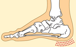skausmas mažų pėdų sąnarių gydymas raiščių ir bendrą peties