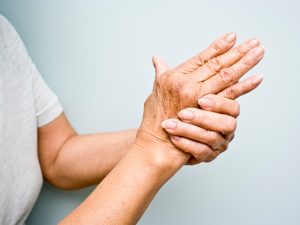 reumatoidinis artritas pirštai šepetys