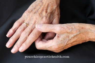 artritas piršto rankų paraudimą