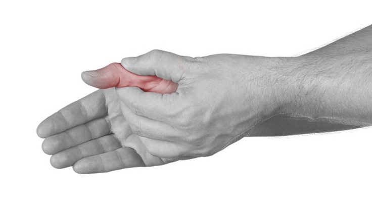 artrozė artritas mažųjų sąnarių šepečiai skauda sąnarį žurnale