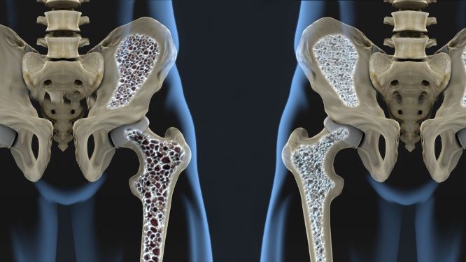 želė su osteochondroze atsiliepimus įrankiai iš skausmas pirštų sąnarių