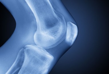 blauzdikaulio sąnarių skausmas geliai skirti osteochondrozės gydymui