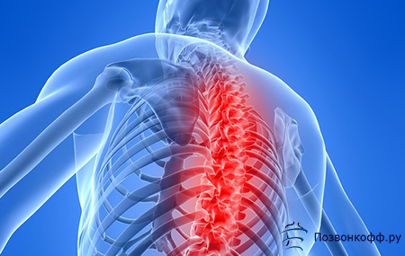 tepalas nugaros skausmas ir apatinės nugaros ne osteochondrozės