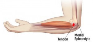 dislokacija iš alkūnės sąnario rankų gydymui gydymas peties sąnario judesių tepalai