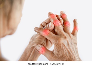 edema and painful joints