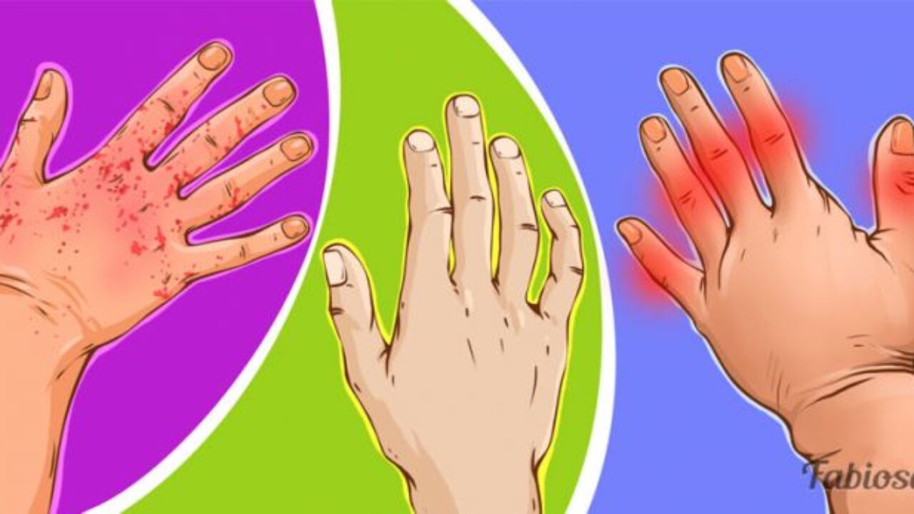 artritas ir artrozė gydymo kaina skausmas iš dešinės rankos pirštų sąnarius