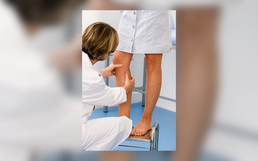kaip gydyti alerginę artritas laikykite jungtinio pirštus