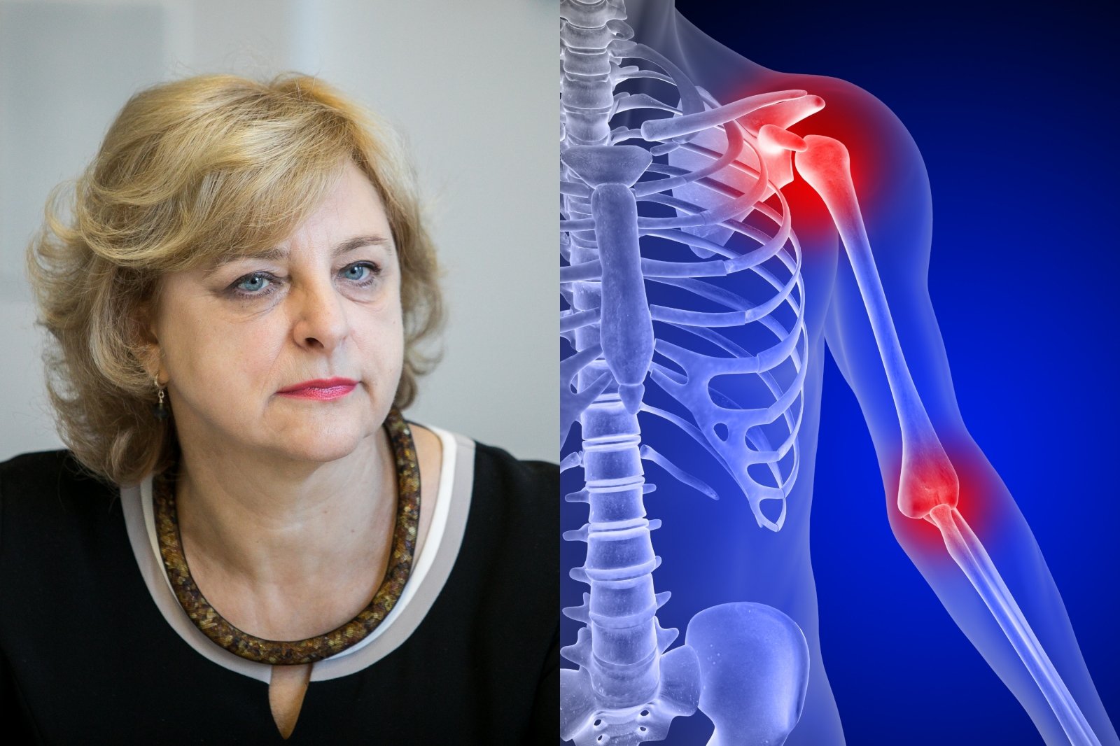 physio gydymas osteoartrito trina tinktūros už sąnarių skausmas