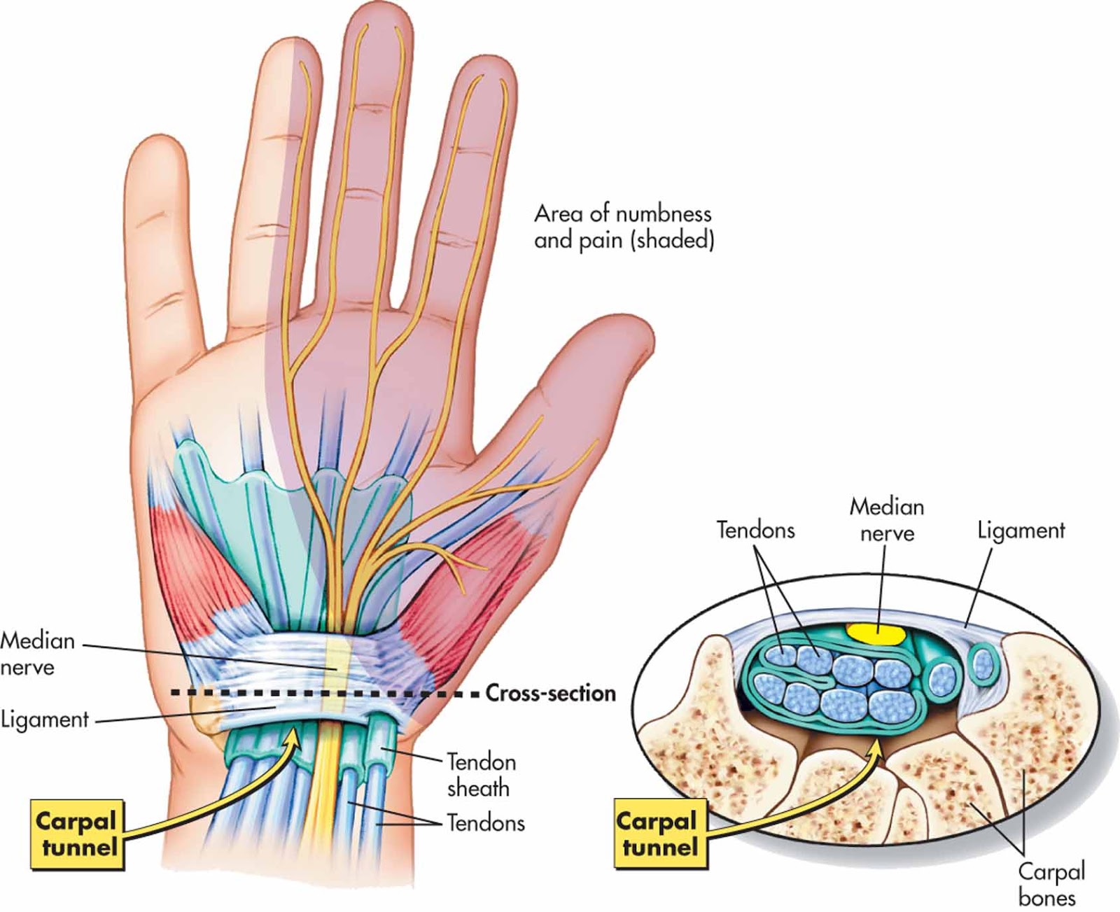 rankų traumos sustav su d_te gydymas