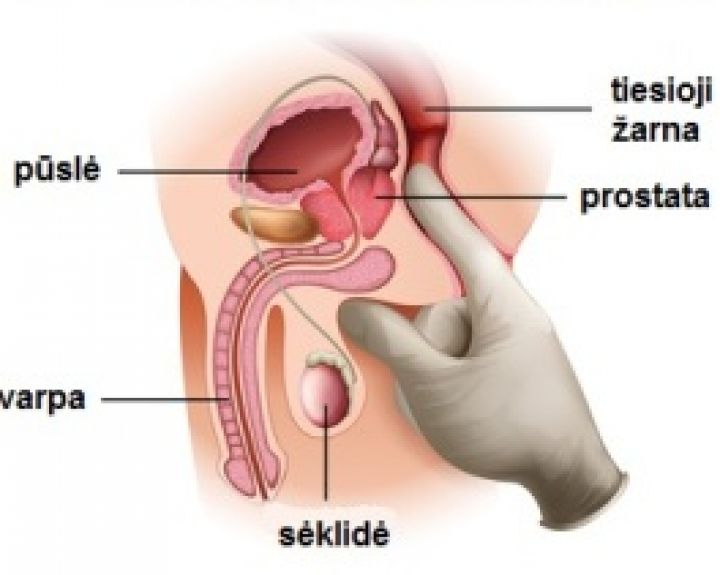 raumenų skausmas ir sąnarių prostatos rankos skausmas tarp peties ir alkunes