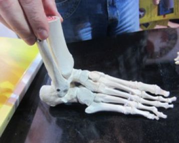 skauda kojos pirsta gerklės riešo sąnario rankų gydymui