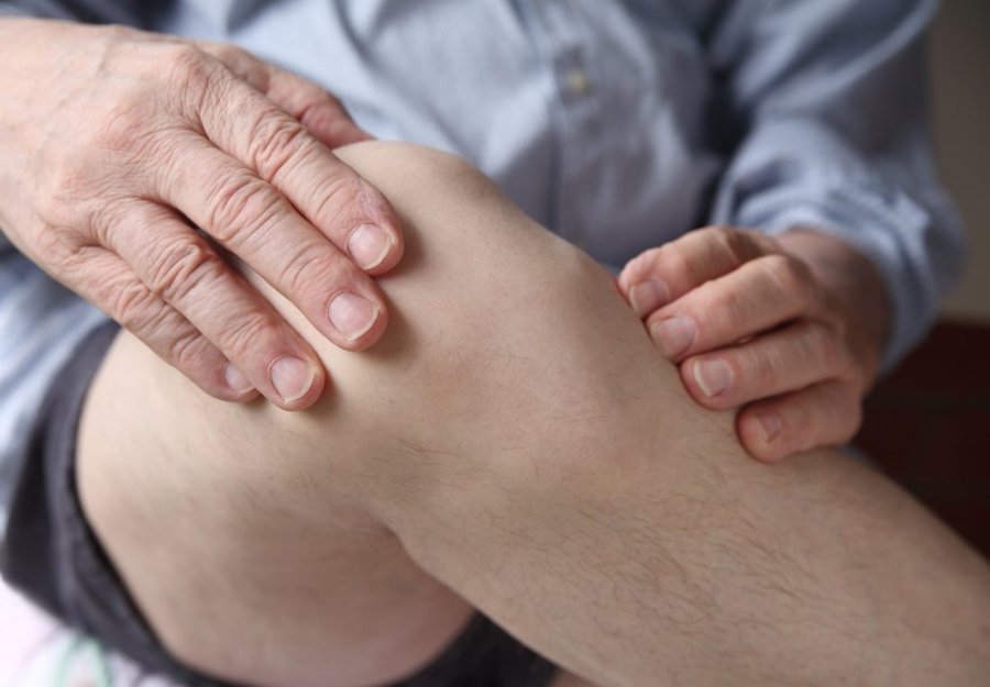 artritas rankas ir kojas