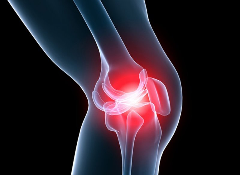 artrozė osteoartrito gydymui broileriai sąnarių liga