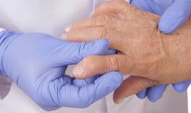 sanariu ligos kaip sumažinti skausmą rankos sąnarių