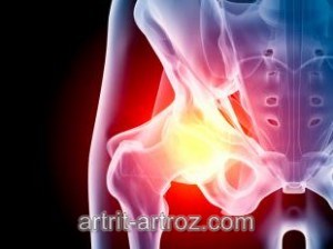 gydymas osteoartrito ir spondylosis kvailas skausmas pečių sąnarių