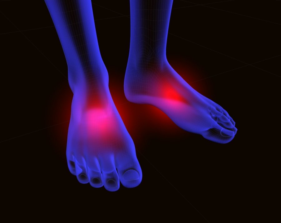 reumatoidinis artritas dėl pėdos sąnarių gydymo stiprus skausmas nugaros apacioje