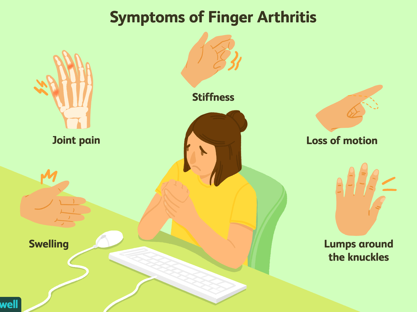 swelling in knuckle joints artrito artrozė koks skirtingas gydymas
