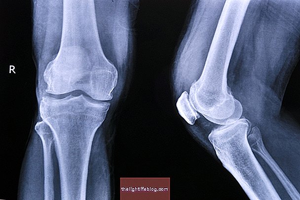 skauda kojos pirsto sanari priežastis nykščio skausmo
