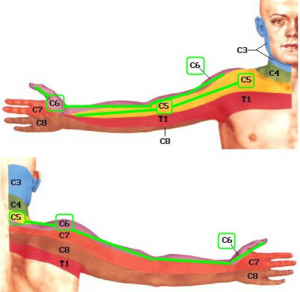 skausmas sąnariuose ir raumenyse rankas nuo peties iki alkūnės iš alkūnės sąnario gydymas po traumų